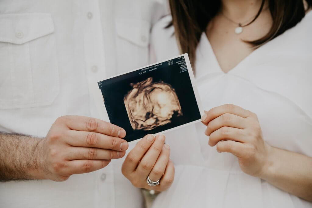 Pregnant woman hold a scan